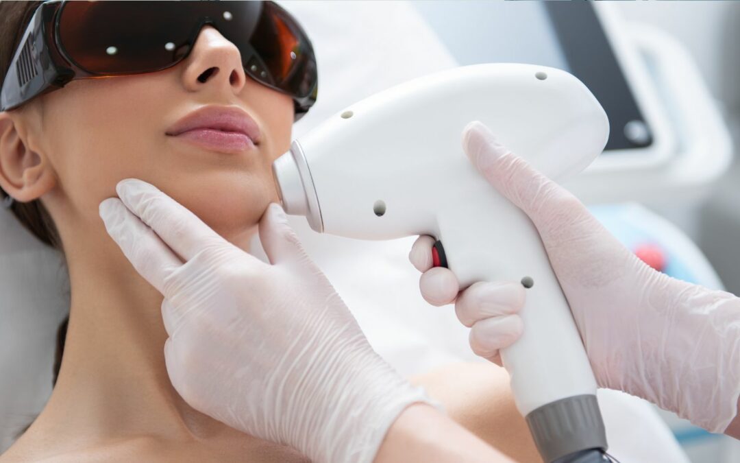 Permanent Hair Removal: A Guide to Laser and IPL