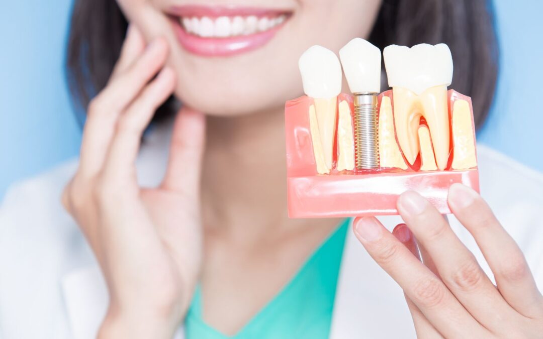 Same-Day and One-Day Dental Implants: How Tooth Replacement Has Evolved — Modern Techniques, Benefits, and What Patients Should Know