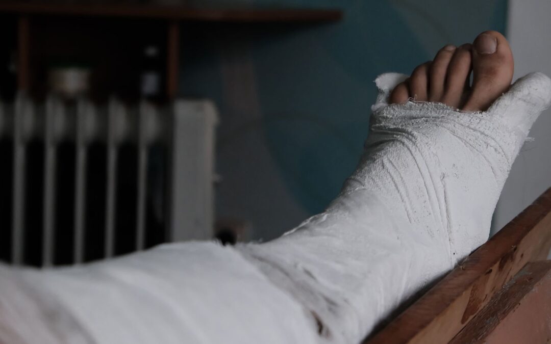 The Adrenaline Mask and Why Injuries Often Hide for Days