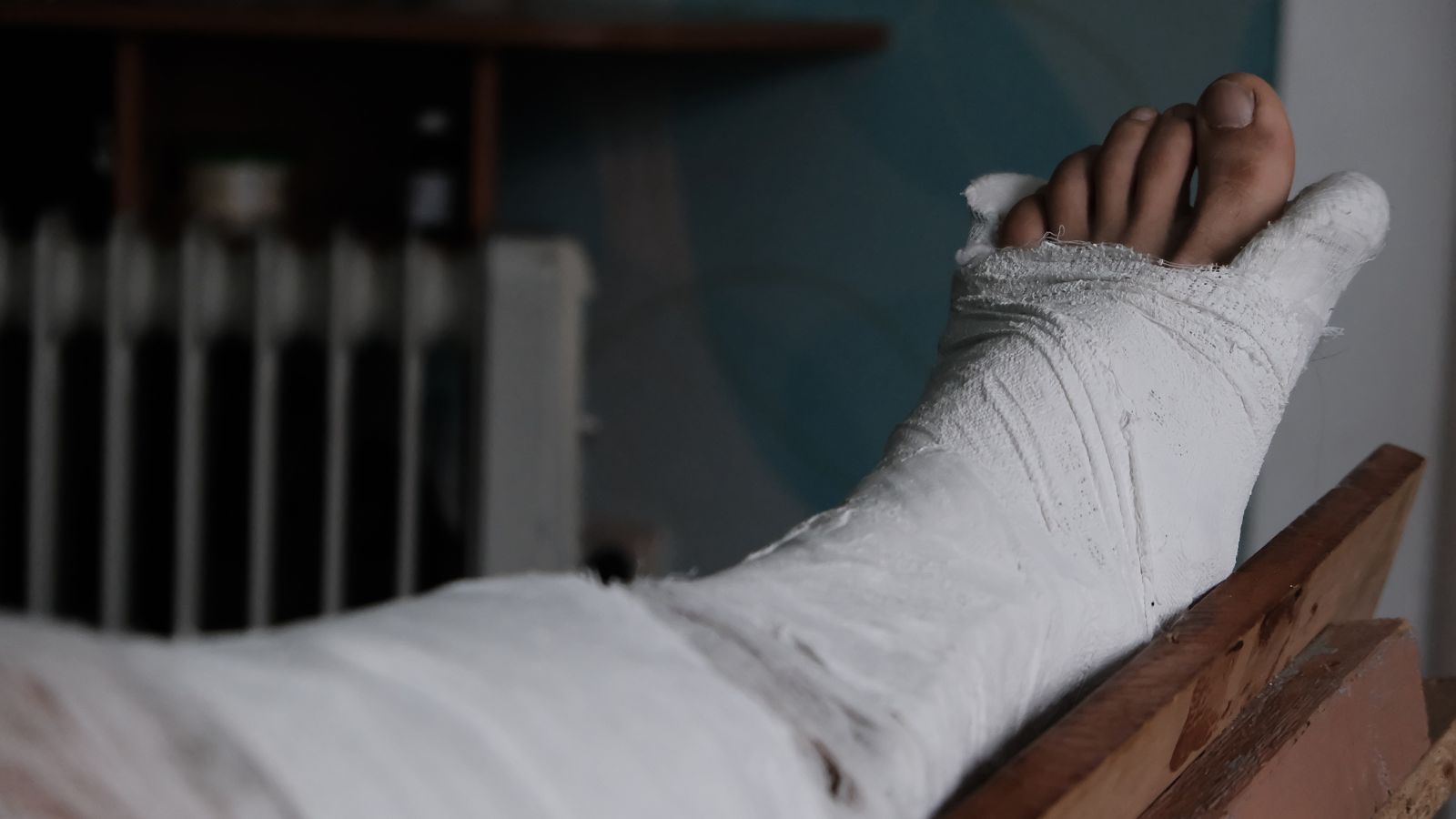 delayed pain