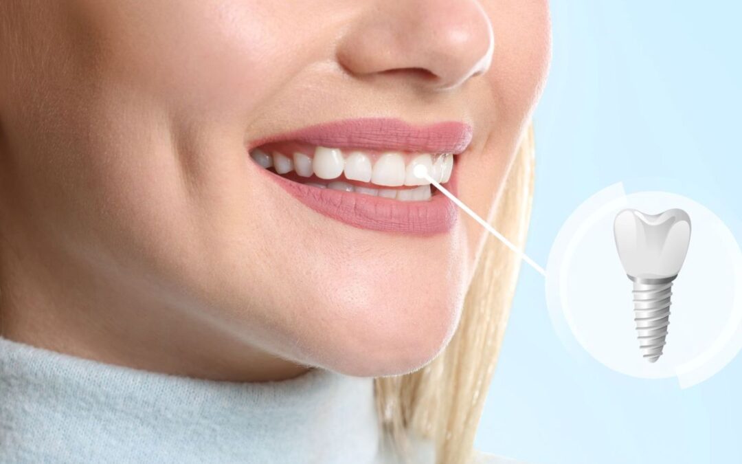 risk of peri-implantitis